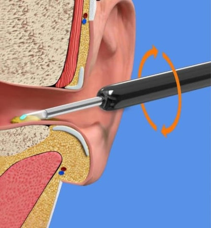 HD Visual Ear Cleaner ~ Safe, clear, and hygienic ear care at home-