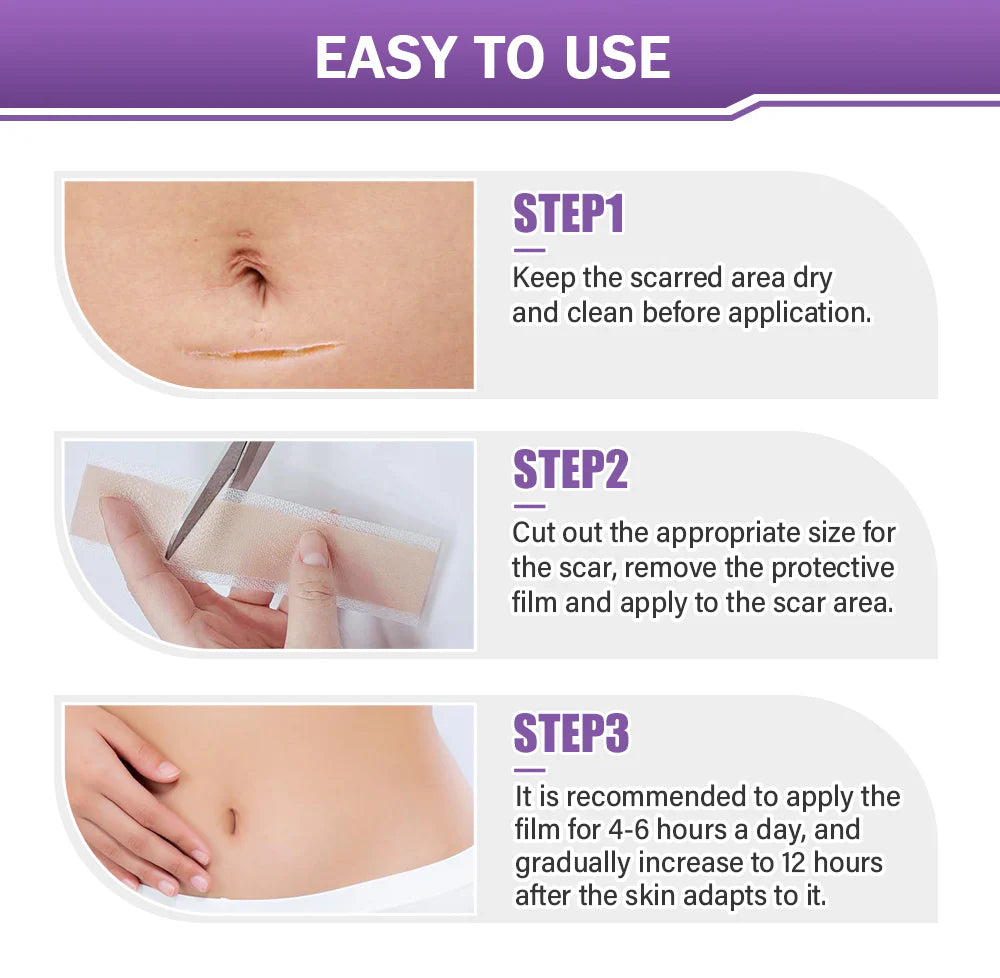 Skin Microneedle Repair Tape ~ Fade scars and stretch marks while you heal.