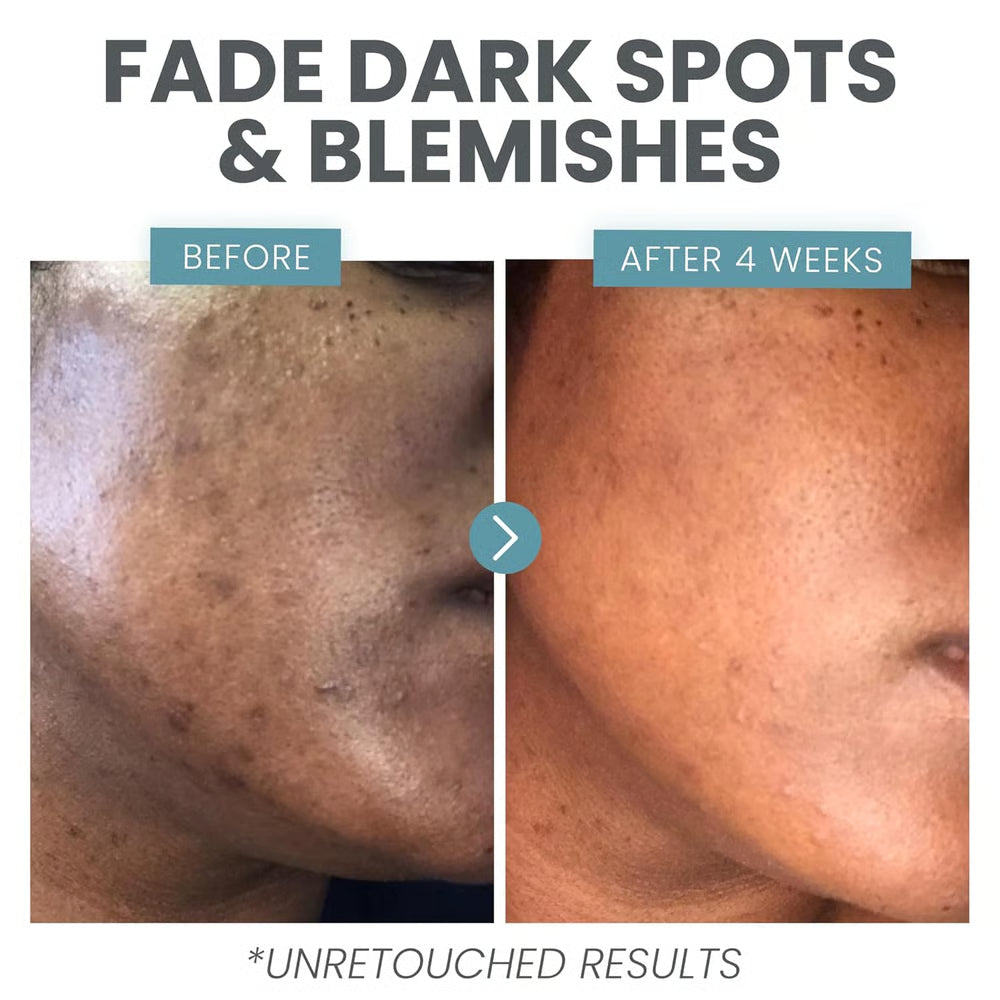 Vitamin C Booster Serum ~ Support glow by day and smoother skin at night.