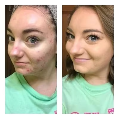 Tri-color Concealer ~ Brighten, conceal & contour with one easy palette.