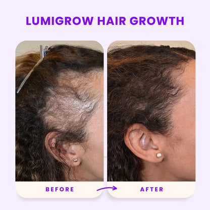 Lumigrow Hair Growth Gummies ~ Clinically proven formula for real results.