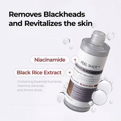 Rice Serum ~ Blackheads Fear This