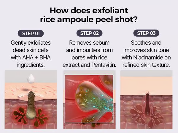 Rice Serum ~ Blackheads Fear This