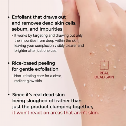 Rice Serum ~ Blackheads Fear This
