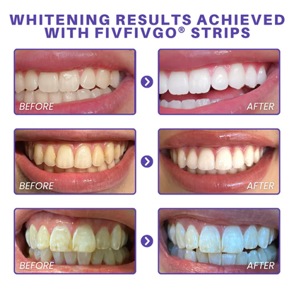 Purple Whitening Teeth Strips ~ Instantly brighten and balance yellow tones in 30 minutes
