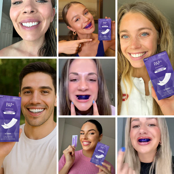 Purple Whitening Teeth Strips ~ Instantly brighten and balance yellow tones in 30 minutes