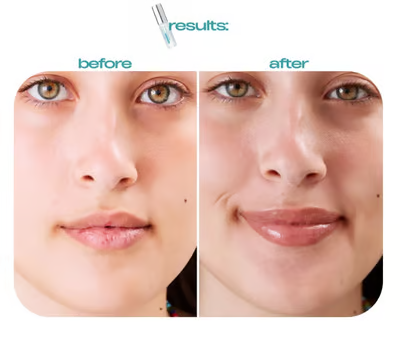 BP Spicule Plumping Lip Shot ~ Get that full, irresistible pout