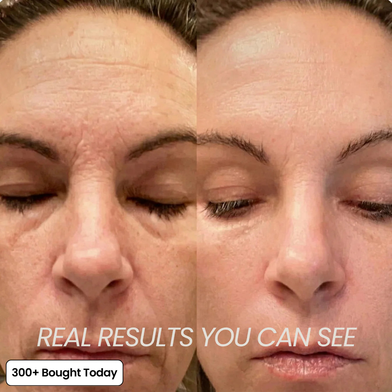 Multi Balm Calcium ~ Fill hollow areas and soften deep lines without needles.