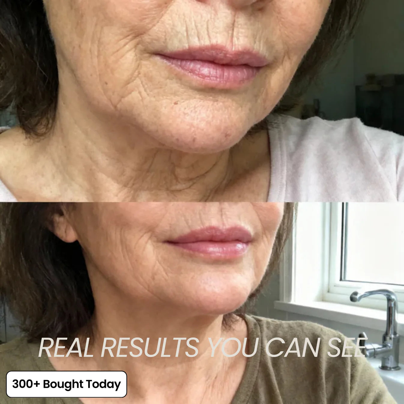 Multi Balm Calcium ~ Fill hollow areas and soften deep lines without needles.