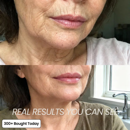 Multi Balm Calcium ~ Fill hollow areas and soften deep lines without needles.